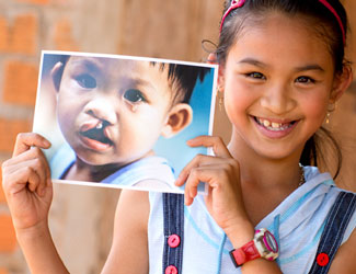 Child smiling holding a photo of them when they were younger with a cleft condition